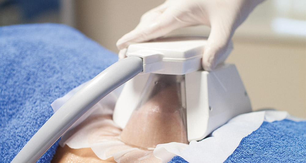 How Fat Freezing and HIFU Work Together? 2 Multiple Areas in One Session HIFU and Fat Freezing Stowmarket