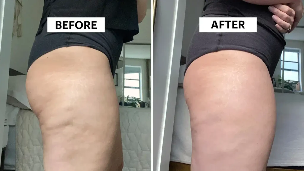 Do Toning Exercise Stowmarket Really Tackle Cellulite?