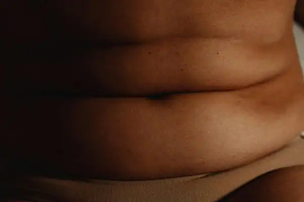 The Hidden Connection: How Stress Shapes Your Fitness and Body Composition 3 image of what stress can do on the stomach area and how Lipo 360 Stowmarket can help to change your body shape.